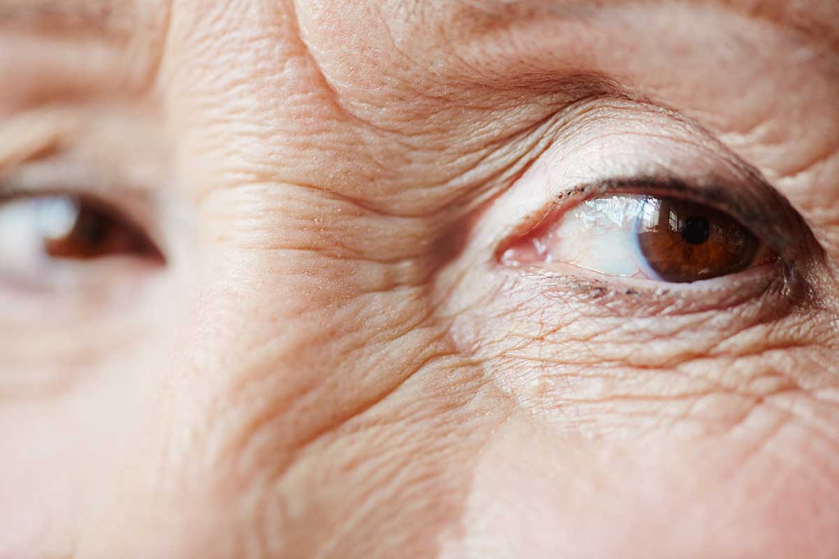 protect your eyes from glaucoma