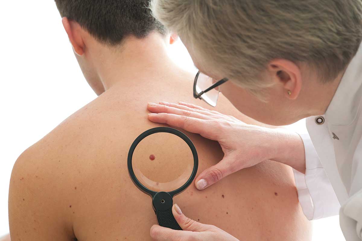 Save Your Skin - Get checked